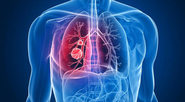 Chronic Obstructive Pulmonary Disease! What is it?